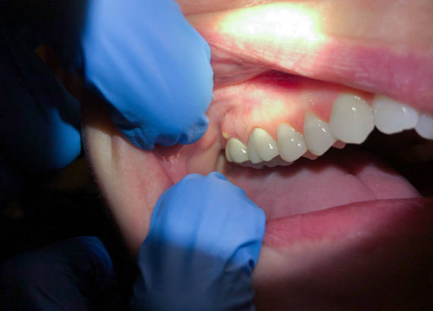 Best Mobile Emergency Dentist in Lake Shore, MD