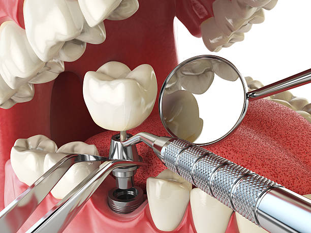 Best Orthodontic Emergency Dentist in Lake Shore, MD
